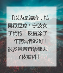 以为是湿疹，结果竟是癌！宁波女子悔惨：反复涂了一年药膏都没好！很多患者首诊都去了皮肤科